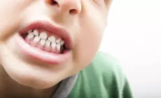 boy shows clenched teeth in close-up